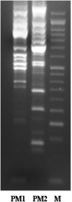 Induction of Different Apoptosis Pathways by Two Proteusmirabilis Clinical Isolates Strains in Prostatic Epithelial Cells